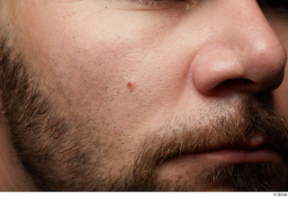  HD Face Skin Arthur Fuller cheek face lips mouth nose skin pores skin texture 0002.jpg